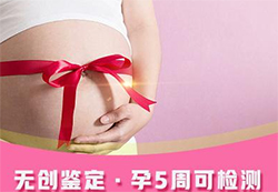 贵阳如何做孕期亲子鉴定