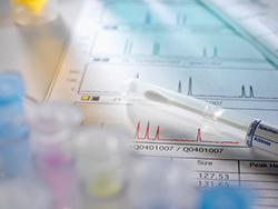 贵阳哪个医院可以做DNA亲子鉴定呢，贵阳医院办理血缘检测的流程